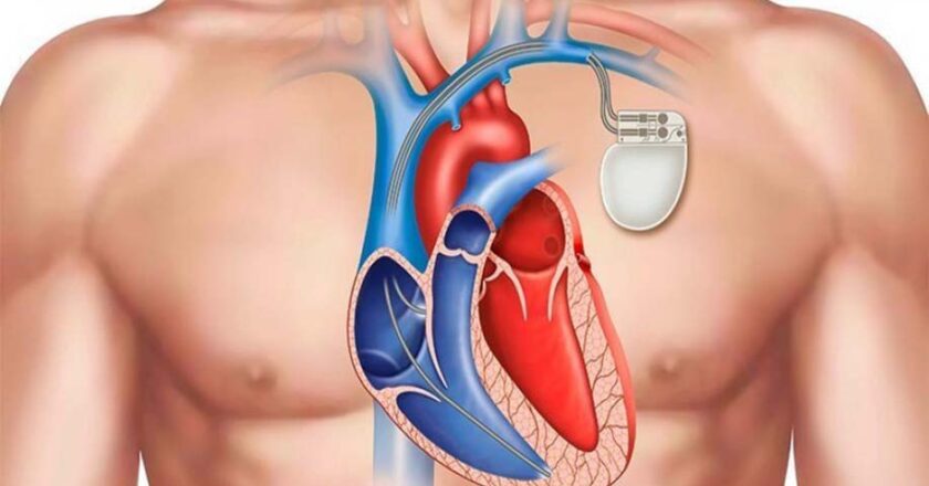 Έλεγχος και ρύθμιση των βηματοδοτών στο Nοσοκομείο Μυτιλήνης